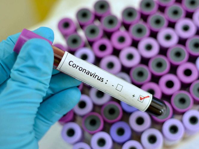 Koronavirus səbəbindən daha bir oyun keçirilmədi - avrokuboklarda