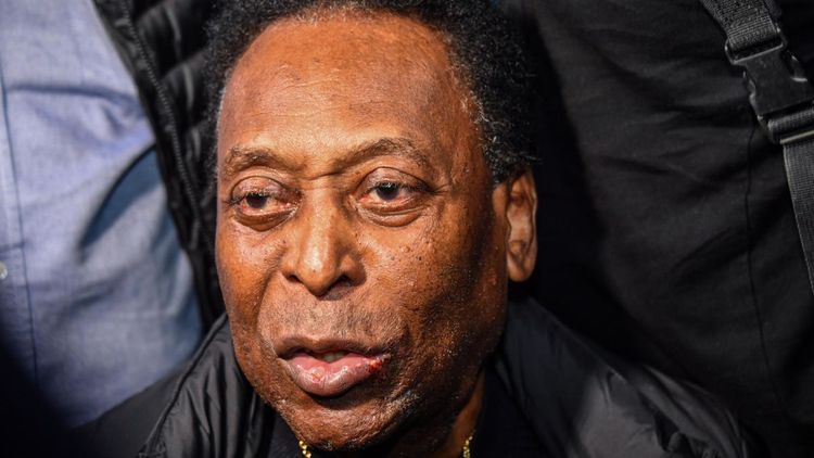 Varisinin adını açıqladı – Pele